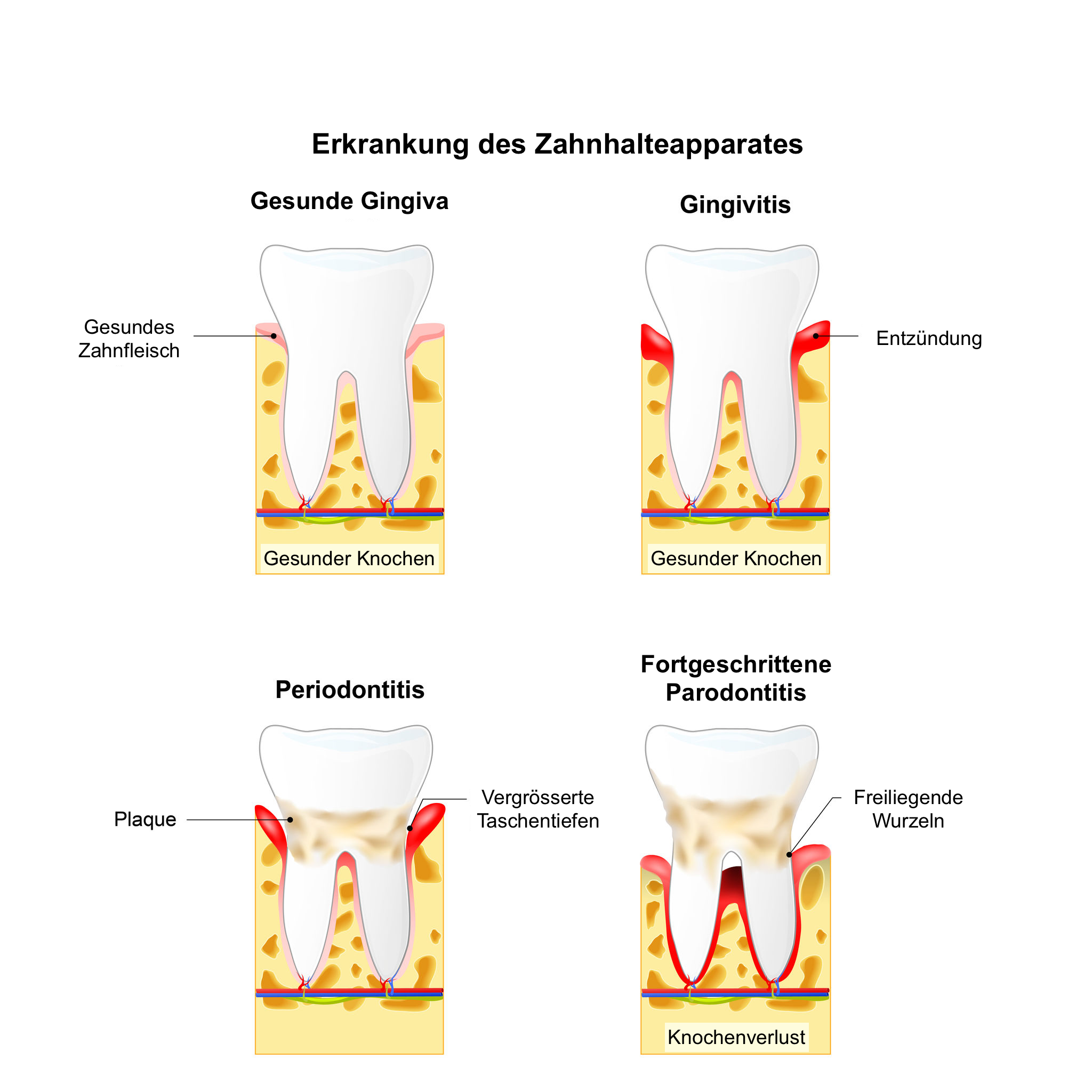 Paradontalchirurgie - IZMK